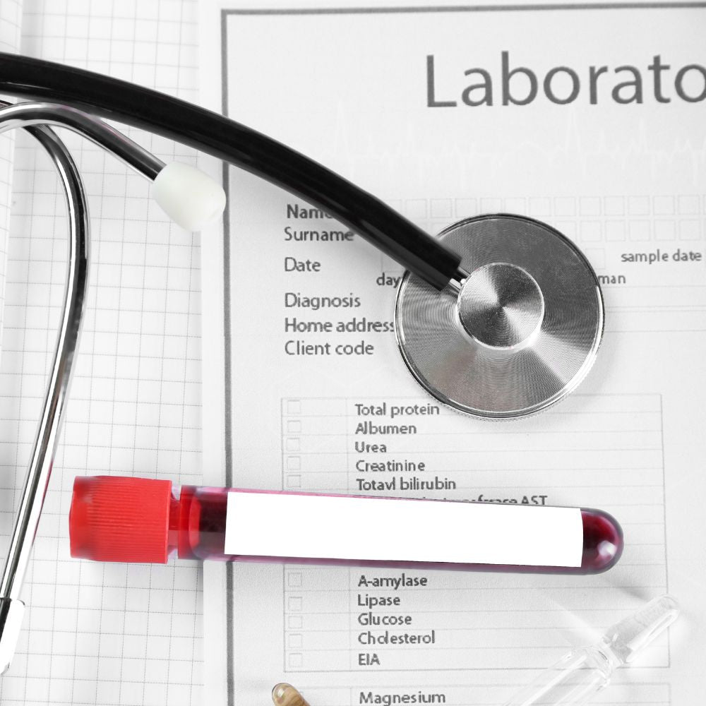 Zöliakie-Antikörper: Werte in der Diagnostik verstehen