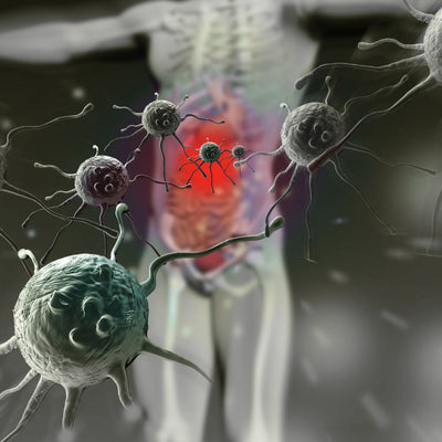 Autoimmunerkrankung