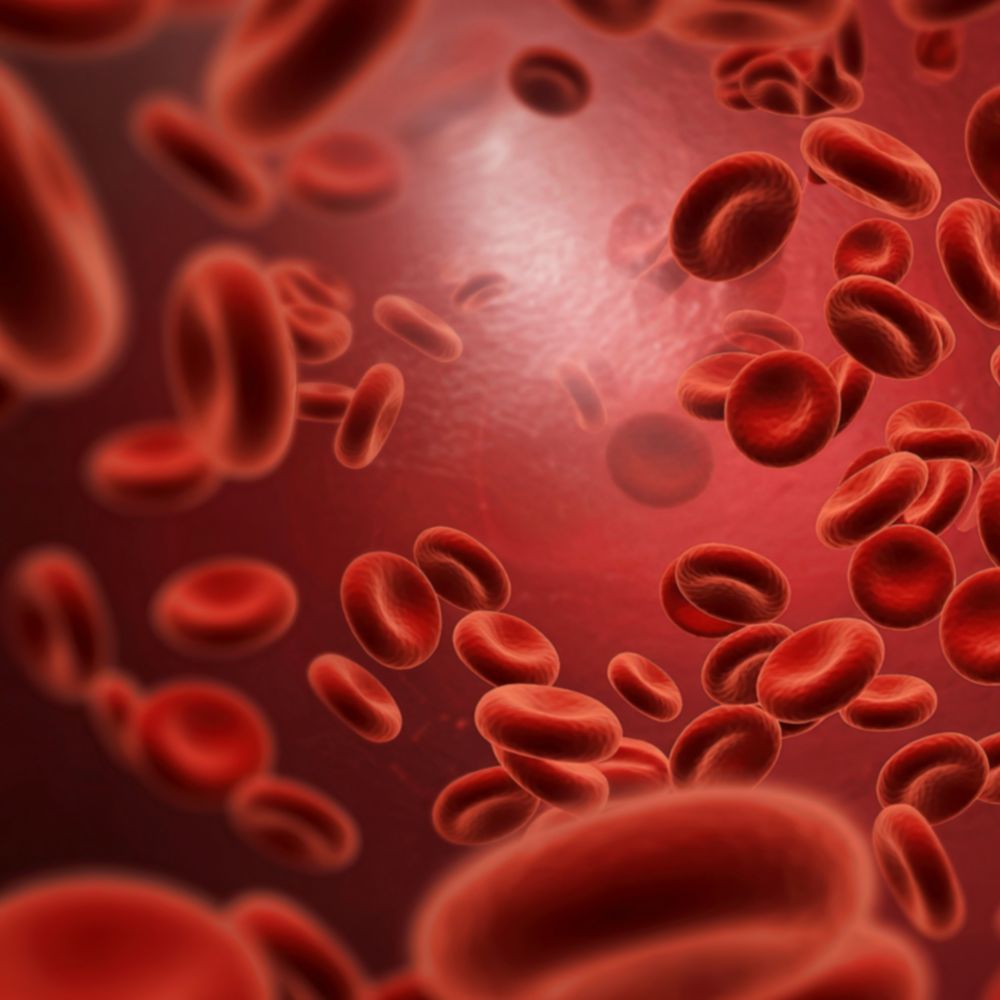 Eisenmangel bei Zöliakie - Schnitzer