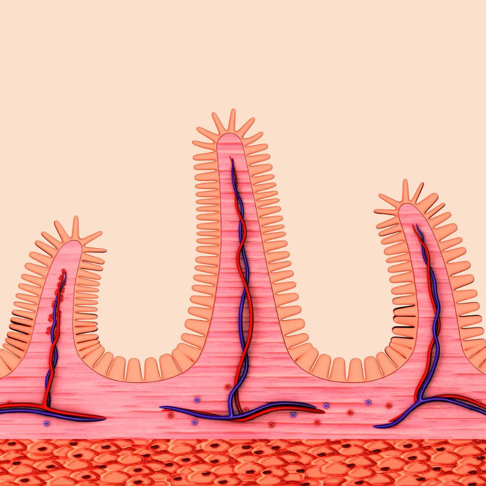 Die Marsh-Kriterien - Schnitzer